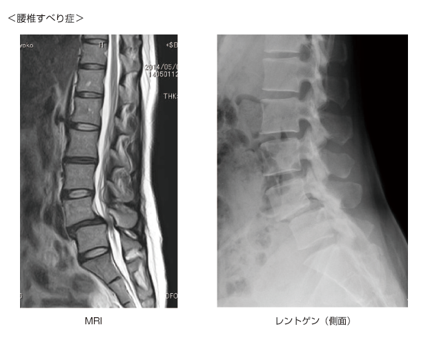 種類とグレード