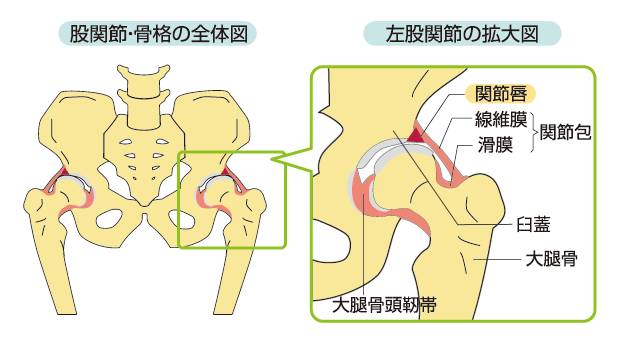 股関節の拡大図